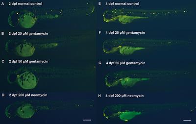 Dynamic Editome of Zebrafish under Aminoglycosides Treatment and Its Potential Involvement in Ototoxicity